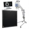 SR-P5D Portable High Frequency X Ray Machine for Human or Vet