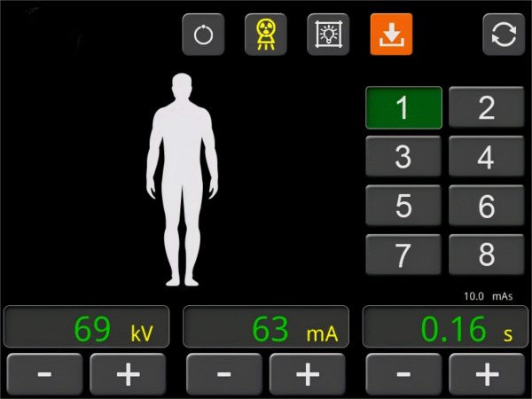 SR35RP-V Portable Digital Radiography X-Ray Machine