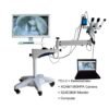 YDJ-II Medical Optical Colposcope Video Colposcope Camera