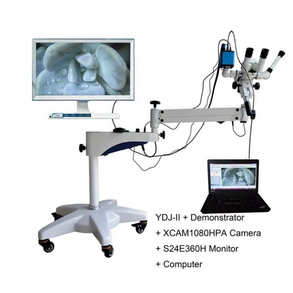 YDJ-II Medical Optical Colposcope Video Colposcope Camera