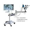 YDJ-II Medical Optical Colposcope Video Colposcope Camera