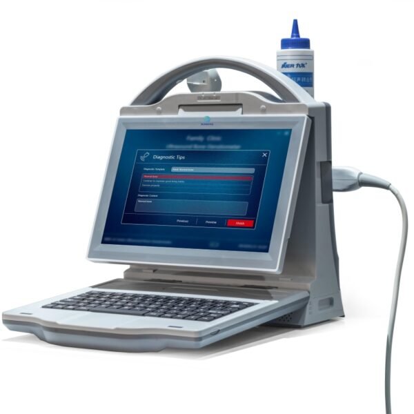 SR-B3 Medical Ultrasound Instruments Automatic Digital Ultrasound Bone Densitometer