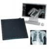 SX-02 Human Vet 14 17*17 Wired or Wireless X-ray Dr Digital Flat Panel Detector System
