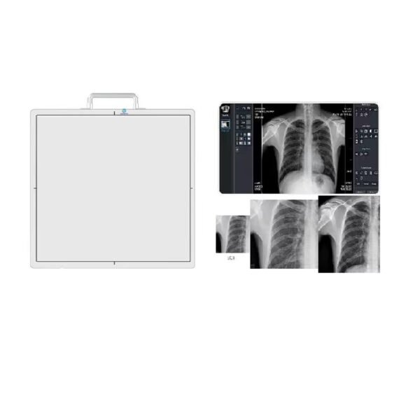 SX-01 Wireless Flat Panel X-ray Detector