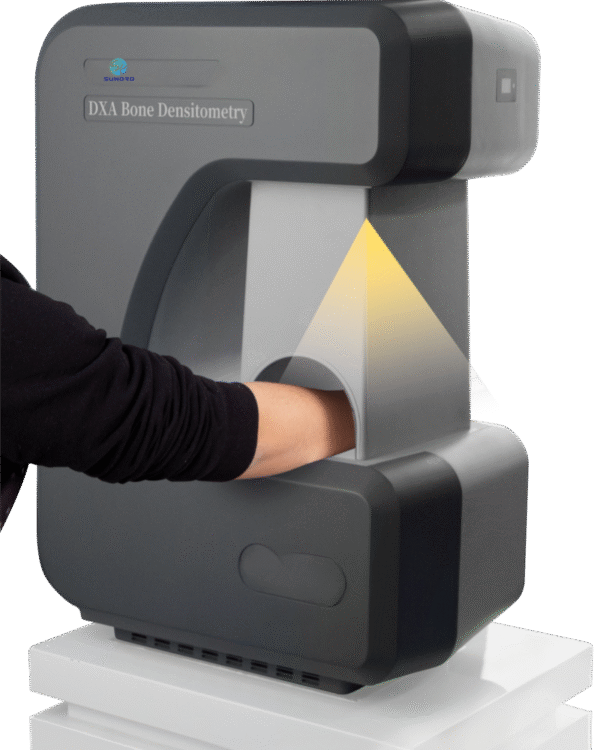 主图 (4) SR-B3 Mobile Scanning Dual Energy X-ray Portable Bone Densitometer Absorptiometry