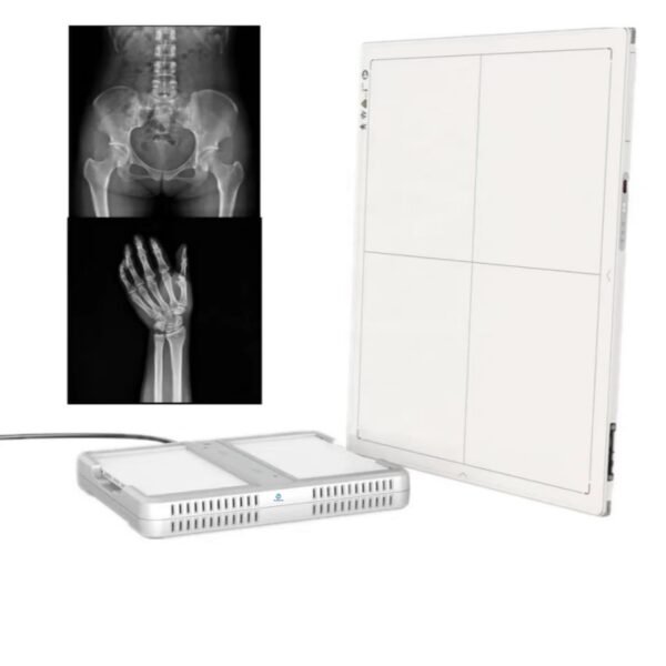 SX-01 Wireless Flat Panel X-ray Detector