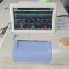 SR-9000B Fetal Monitor 7-inch Screen Automatic Analysis Diagnosis Built-in Lithium Battery Electricity Powered