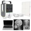 SR-5A Medical Digital Portable Xray Diagnostic X-ray System