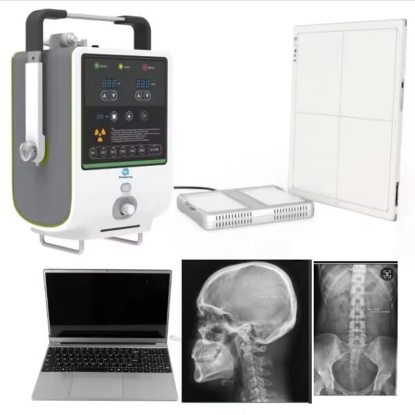 SR-5A Medical Digital Portable Xray Diagnostic X-ray System