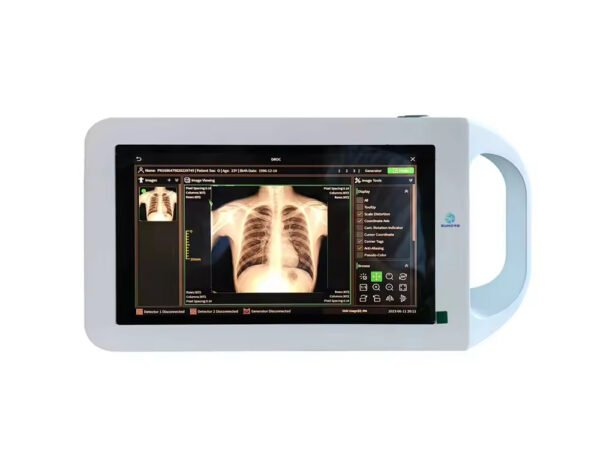 Main-03 KPS10 Medical Portable Xray Mini High Frequency Portable Xray Machine Cheap Price