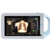 KPS800 Handheld Portable X-ray Factory Price Portable Handheld Light Weight 800W X-ray Machine for Humans and Animals