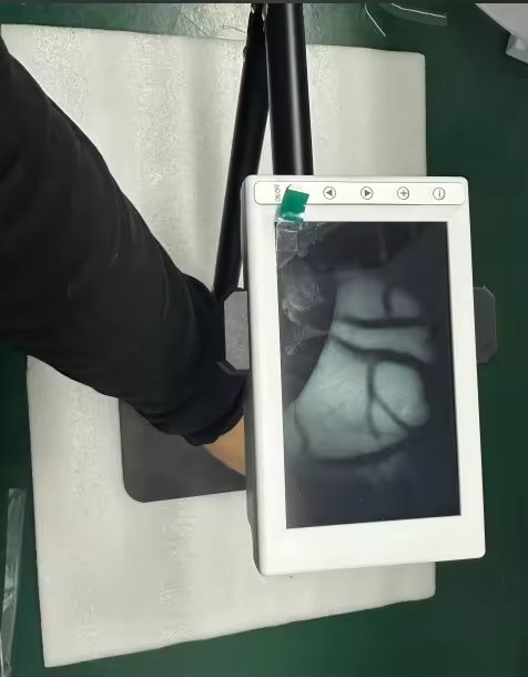 Main-01 AV300 Medical Vascular Infrared Vein Detector Vascula Distribution Visualization Vein Finder Devices