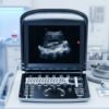 Main-01 ECO 1 Sunoro Ultrasound Good Quality Black and White Ultrasound