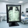 Main-01 SG3213 Medical Diagnostic Display 2048*1536 2048 Grayscale, 1000cd/m² for X-ray Radiology Reading