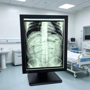 Main-01 SG3213 Medical Diagnostic Display 2048*1536 2048 Grayscale, 1000cd/m² for X-ray Radiology Reading