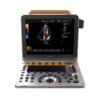 Main-02 DW-P60 Portable Version Factory Made Strictly Checked Handheld Color Doppler Elastography Blood Flow Veterinary Ultrasound