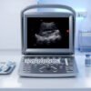 Main-02 ECO 1 Sunoro Ultrasound Good Quality Black and White Ultrasound