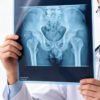FI-8x10 Good Quality X-ray Film Medical Based Dry Imaging Xray Film