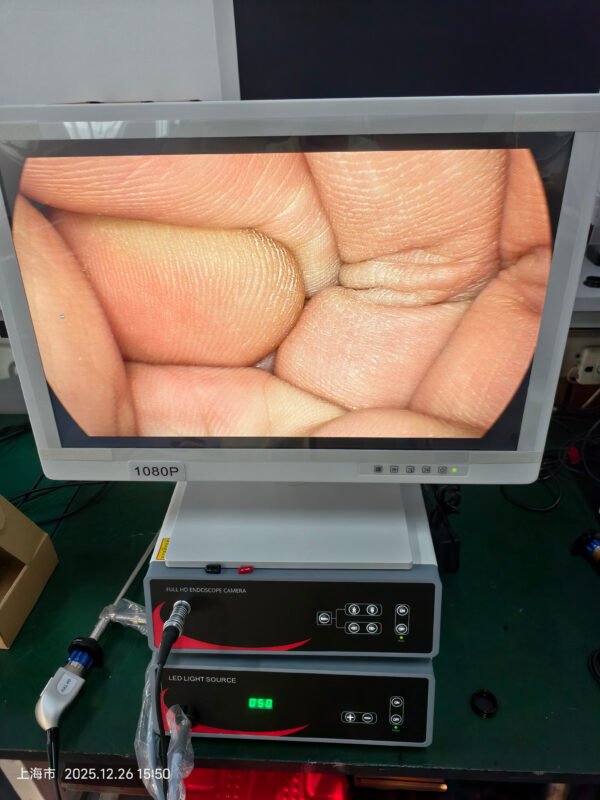 SRH-1100H Hysteroscope Set Medical Endoscopy System for Hysteroscopic Surgery