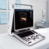 Main-04 EBit 20 Sunoro Ultrasound Good Quality Color Doppler Ultrasound Machine