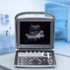 Main-04 ECO 1 Sunoro Ultrasound Good Quality Black and White Ultrasound