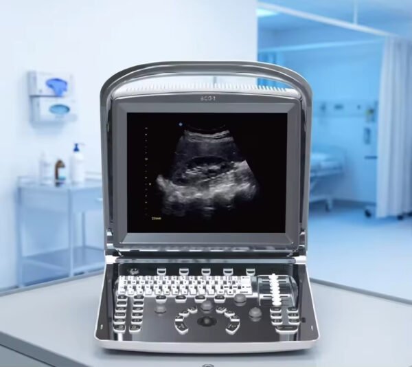 Main-04 ECO 1 Sunoro Ultrasound Good Quality Black and White Ultrasound