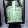 Main-04 SG3213 Medical Diagnostic Display 2048*1536 2048 Grayscale, 1000cd/m² for X-ray Radiology Reading