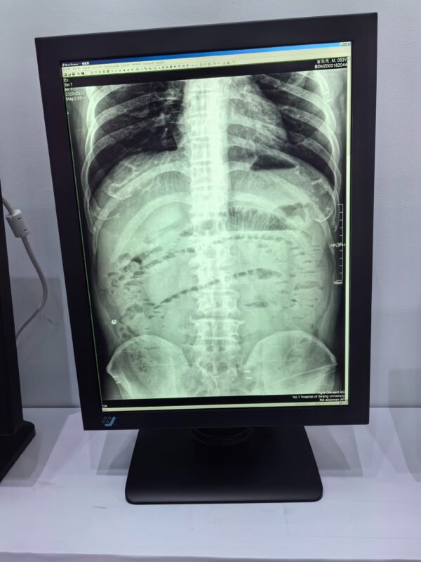 Main-04 SG3213 Medical Diagnostic Display 2048*1536 2048 Grayscale, 1000cd/m² for X-ray Radiology Reading