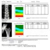 Main-04 DXA-600 Dual-Energy X-ray Bone Densitometry China Bone Densitometer Price New XRay Bone Densitometer Machine