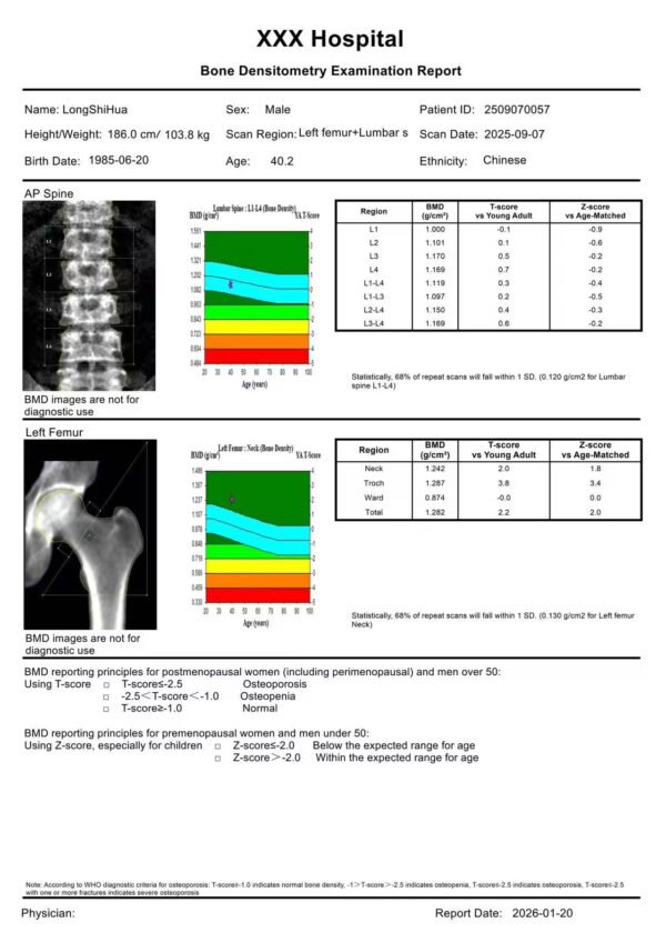 Main-04 DXA-600 Dual-Energy X-ray Bone Densitometry China Bone Densitometer Price New XRay Bone Densitometer Machine
