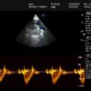 Main-05 DW-L50 4D 5D Portable Color Doppler Human Ultrasound Machine Laptop Diagnostic Ultrasound Device for Obstertrics