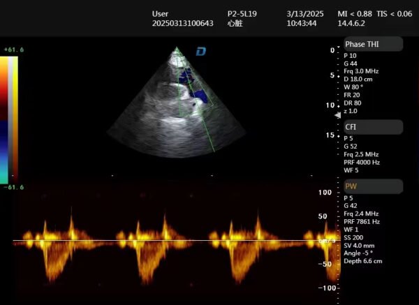 Main-05 DW-L50 4D 5D Portable Color Doppler Human Ultrasound Machine Laptop Diagnostic Ultrasound Device for Obstertrics