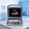 Main-05 ECO 1 Sunoro Ultrasound Good Quality Black and White Ultrasound