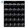 Main-05 X-ray Film Medical Based Dry Imaging Xray Film for Making X-ray Film