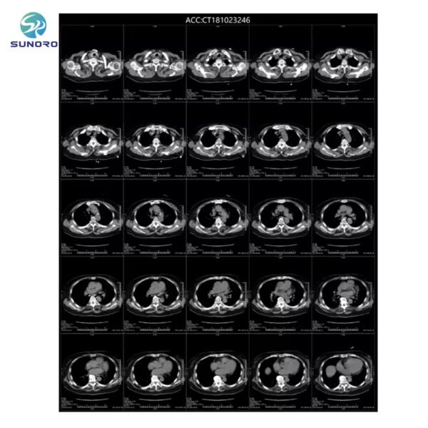 Main-05 X-ray Film Medical Based Dry Imaging Xray Film for Making X-ray Film