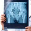 FI-8x10 Good Quality X-ray Film Medical Based Dry Imaging Xray Film