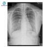 Main-06 X-ray Film Medical Based Dry Imaging Xray Film for Making X-ray Film