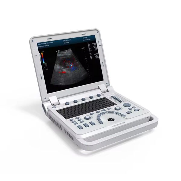CMS1700B Ultrasonic Instrument Laptop Digital 15 Led Display Easy to Carry